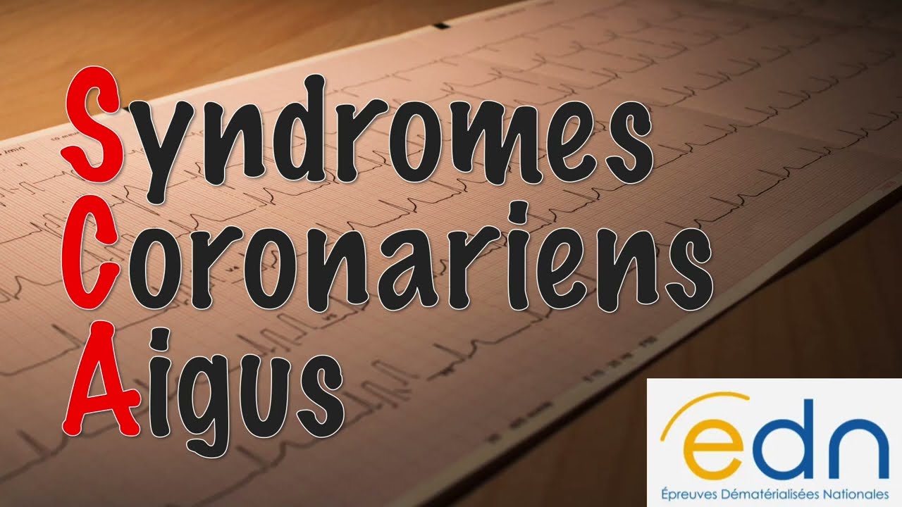 Syndromes coronariens aigus - Item 339 de l'EDN médecine