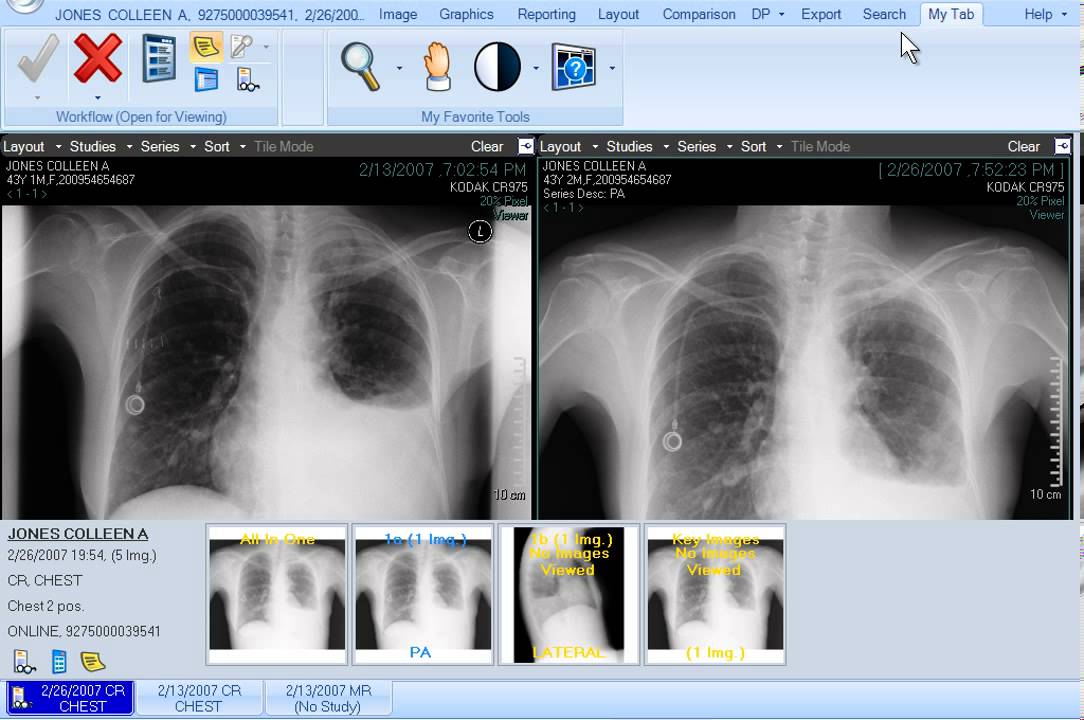 CARESTREAM Vue for Radiology: Image Display