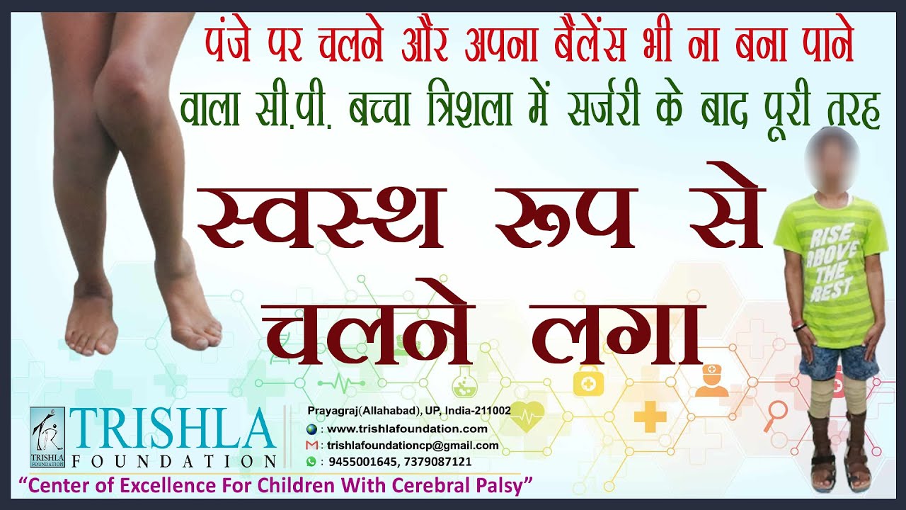 Cerebral Palsy: Exceptional Support for My Son by the Trishla Foundation Team