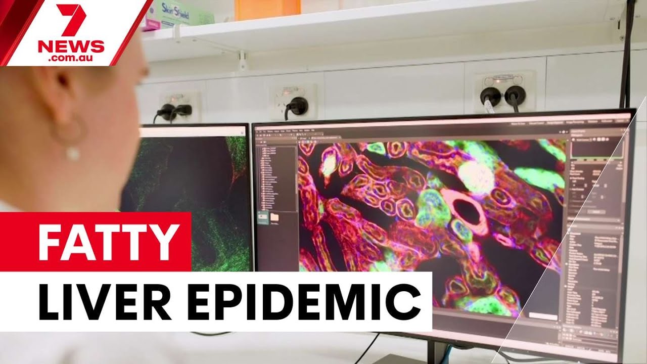 Major research program targets Australia's fatty liver epidemic | 7NEWS