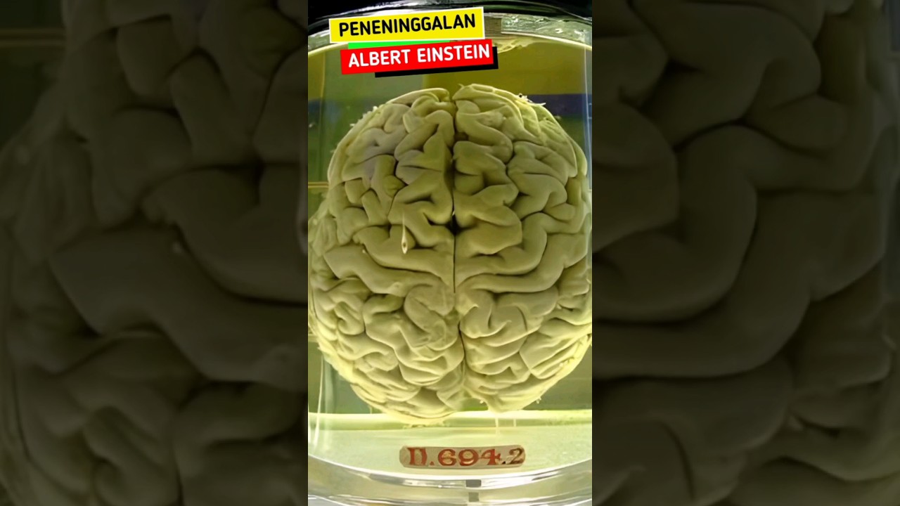 Mengapa Otak Albert Einstein Diawetkan? #shorts