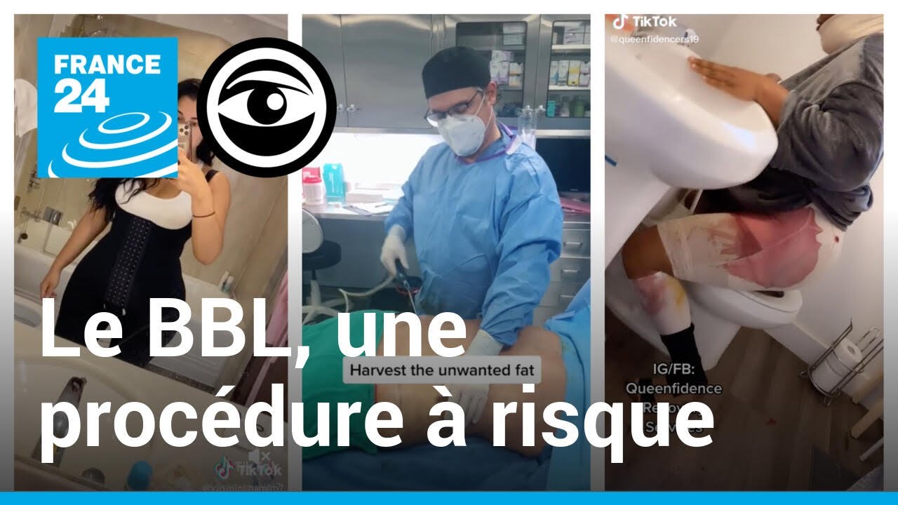 Brazilian Butt Lift : une opération de chirurgie esthétique dangereuse, devenue tendance sur TikTok
