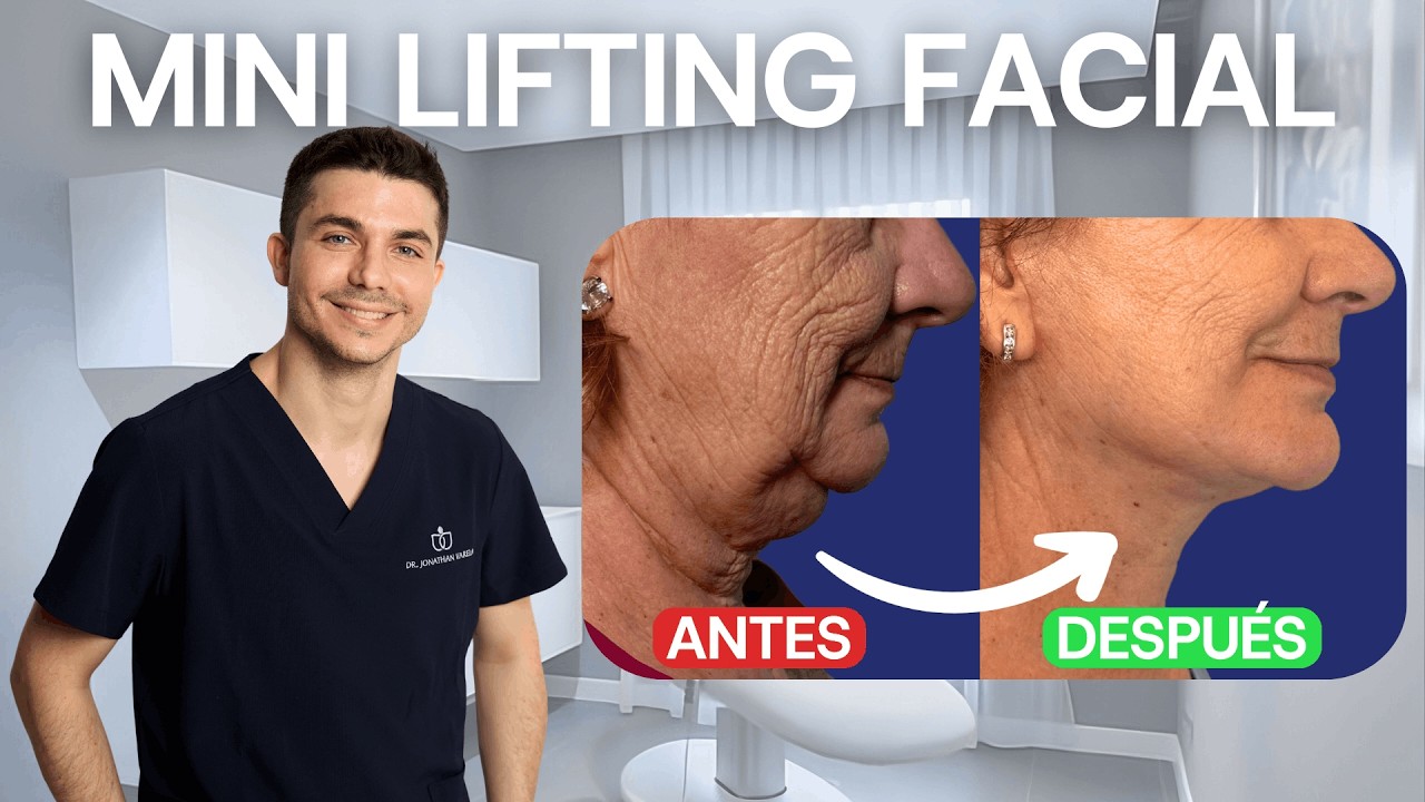 🔴 LIFTING FACIAL VS MINI LIFTING: ¿CUÁL ES LA DIFERENCIA? 👩‍🦰
