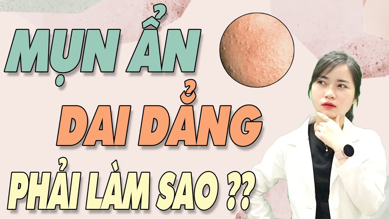 MỤN ẨN DAI DẲNG, bị đi bị lại phải làm sao? Cách trị mụn ẩn hiệu quả|Bs Nguyễn Ngọc