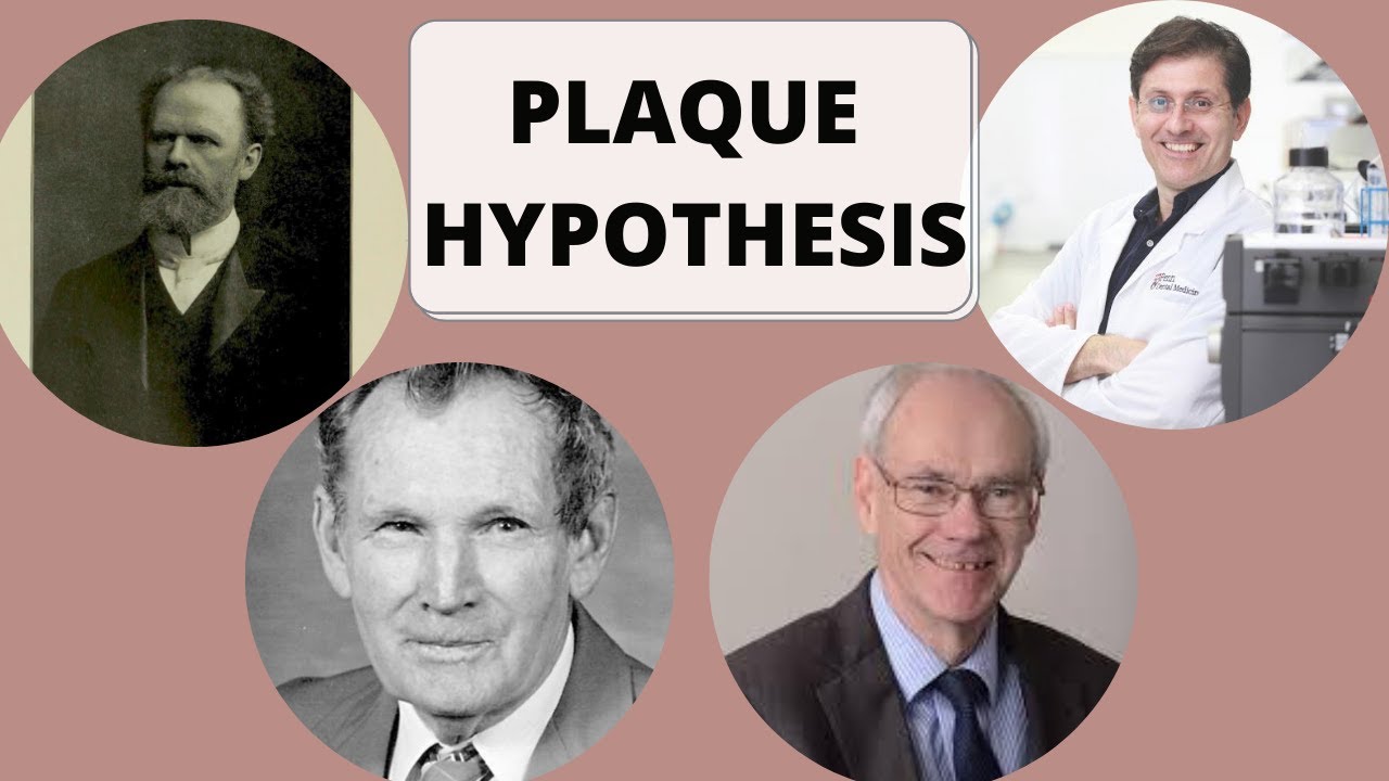 PLAQUE HYPOTHESIS IN PERIODONTAL DISEASE (Dental Plaque Part 3)