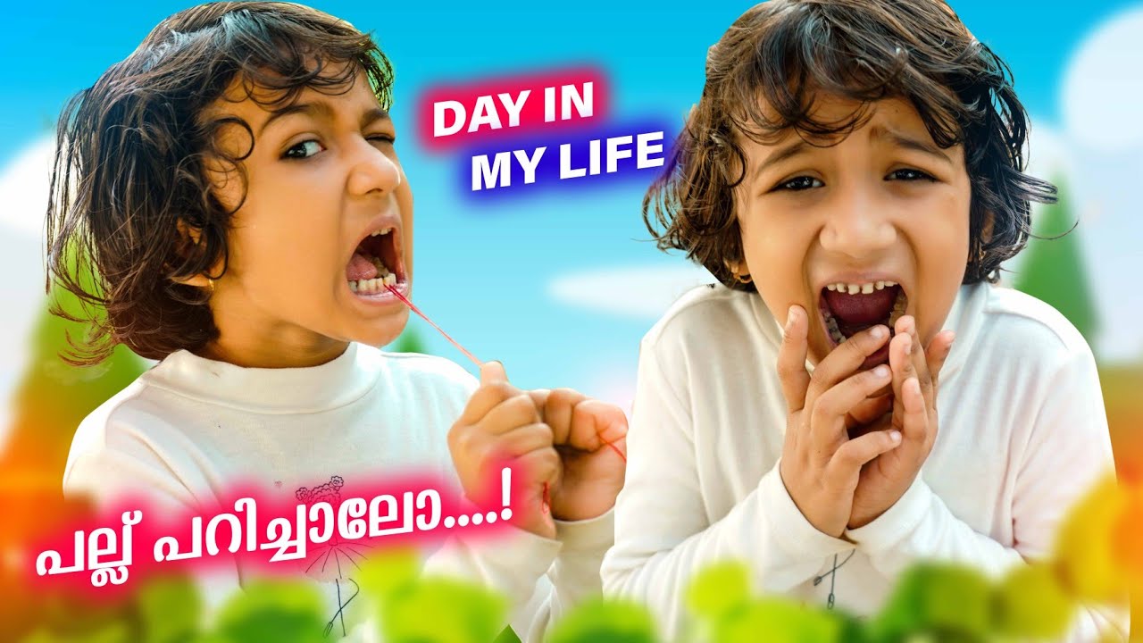 പല്ല് പറിച്ചാലോ🤕... LOOSE TOOTH🦷 | DAY IN MY LIFE | SUPER ZAIBA👸