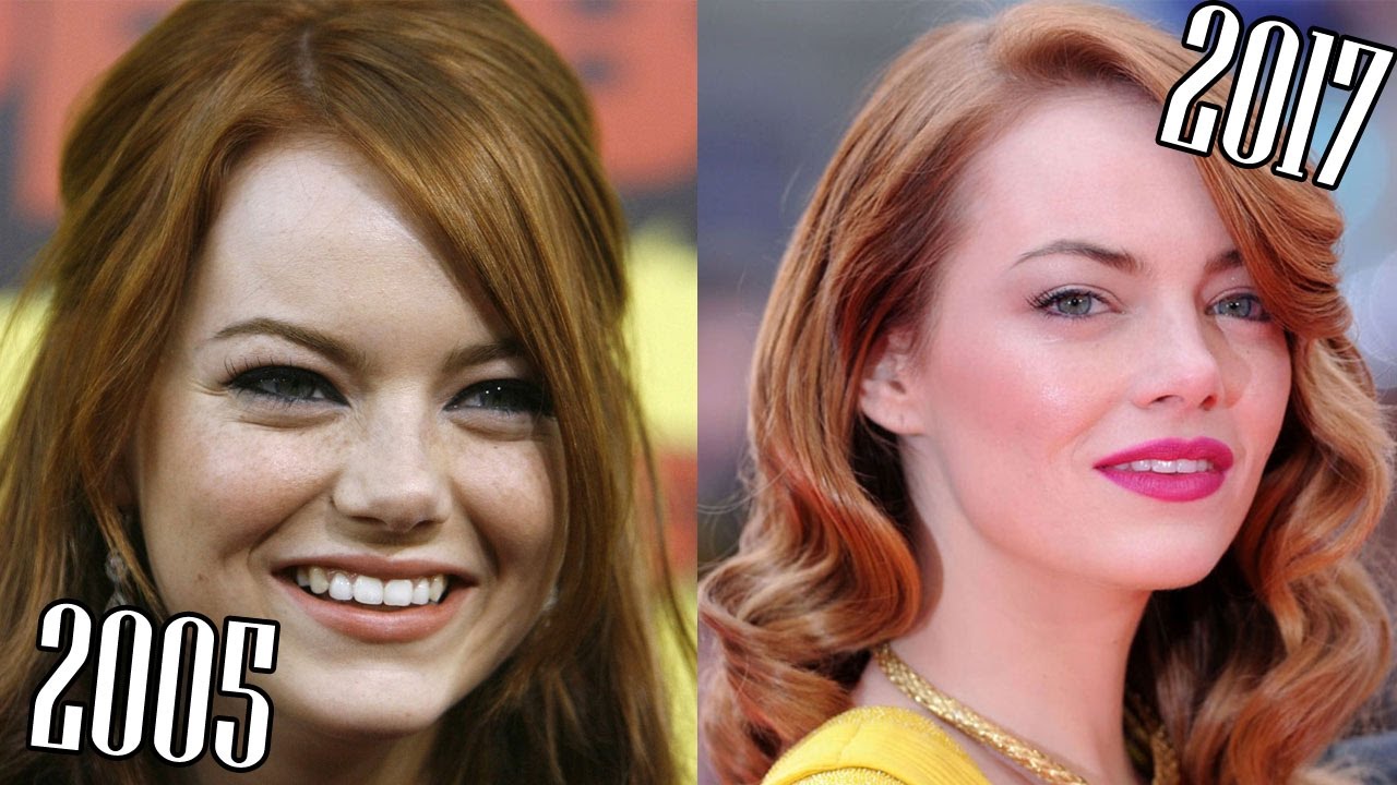 Emma Stone  (2005-2017) all movies list from 2005! How much has changed? Before and After!