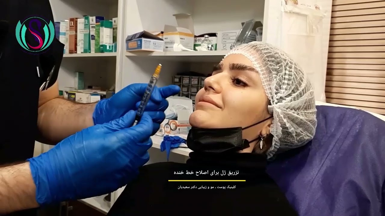 دکتر سعیدیان از بایدها و نبایدهای تزریق ژل می‌گوید!