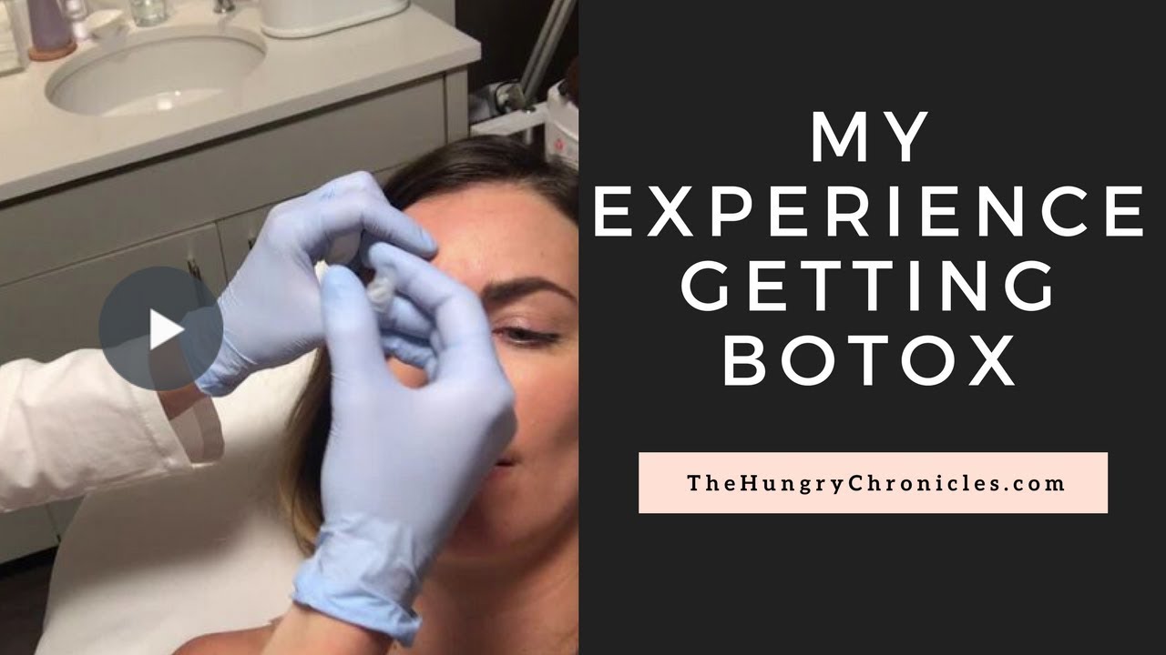 My First Time Getting Botox: Before and After