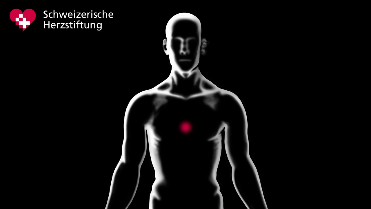 Herzinfarkt: Anzeichen erkennen