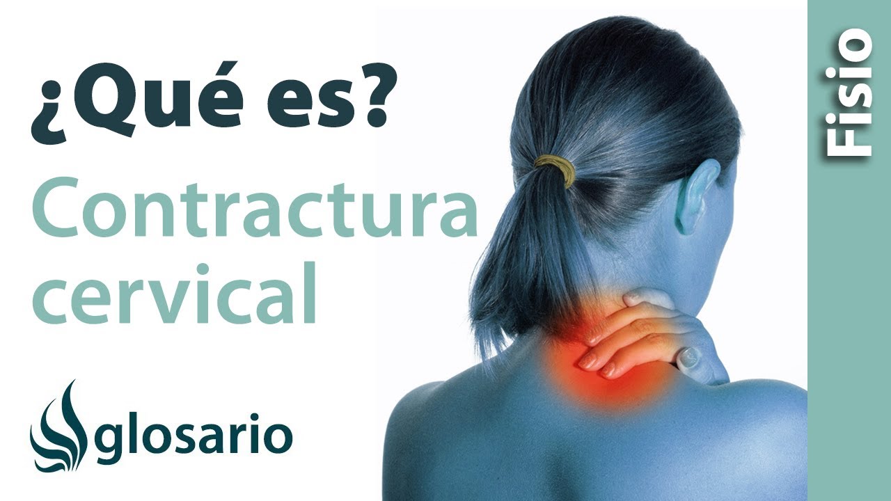 CONTRACTURA CERVICAL | &iquest;Qu&eacute; es?