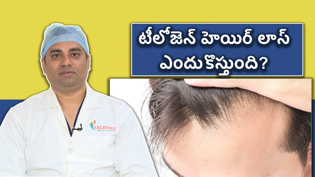 What is Telogen effluvium know here Symptoms Treatment and Recovery | Samayam Telugu