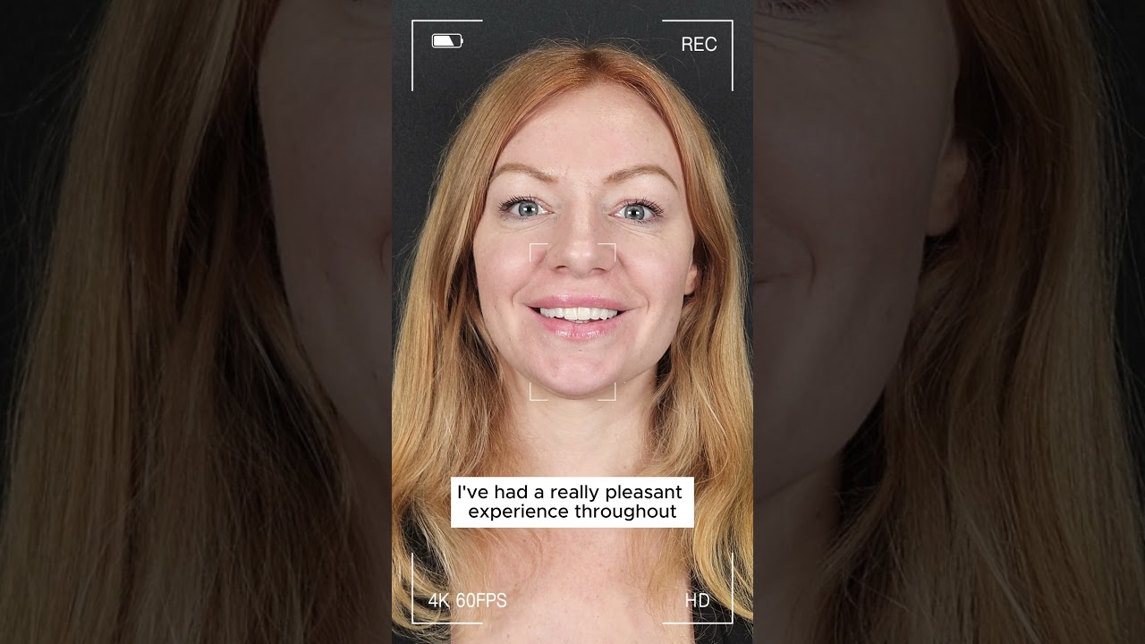 Zirconium Crowns Smile Transformation | Suzanne’s Story from the UK