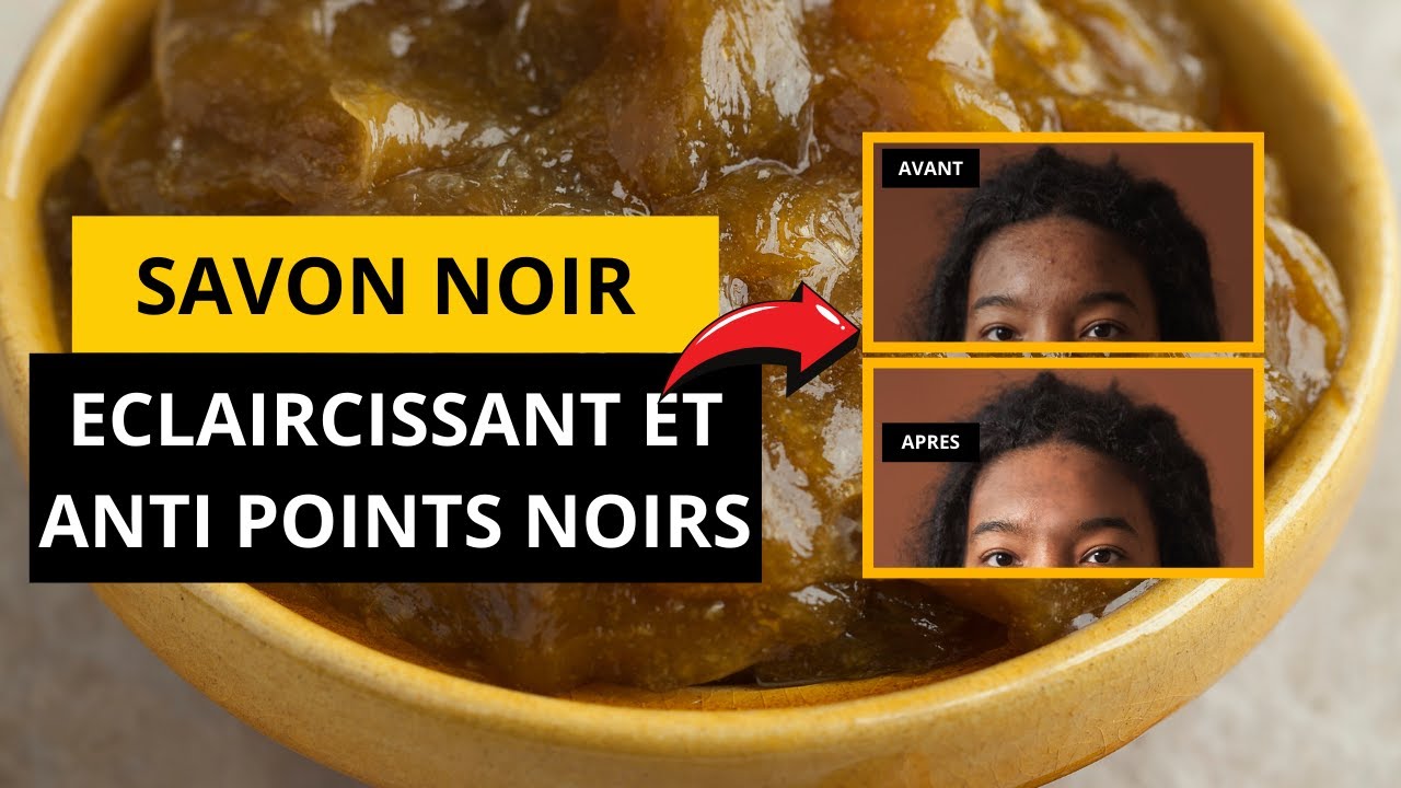 Savon noir éclaircissant contre l'acné et les points noirs