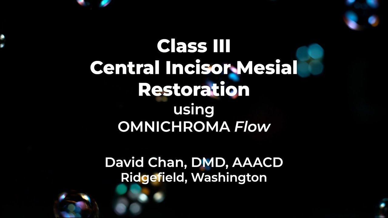 Class III Central Incisor Mesial using OMNICHROMA Flow