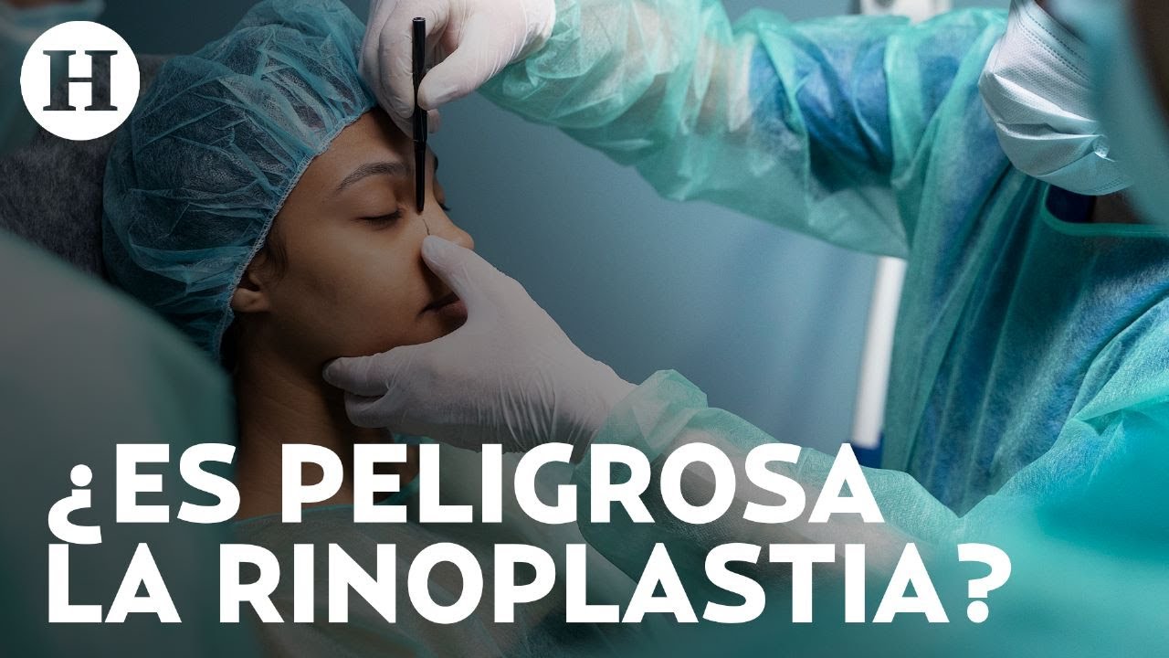 ¿No te gusta tu nariz? La rinoplastia es la cirugía plástica más común, conoce riesgos y cuidados