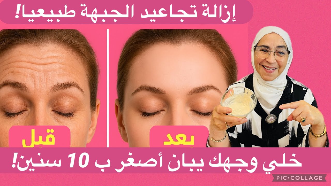 أنا مسؤولة عن كلامي بشرتك غادي تبدّل! تجاعيد الجبهة والعميقة  تهناي منها بهاد السر اللي عندي!