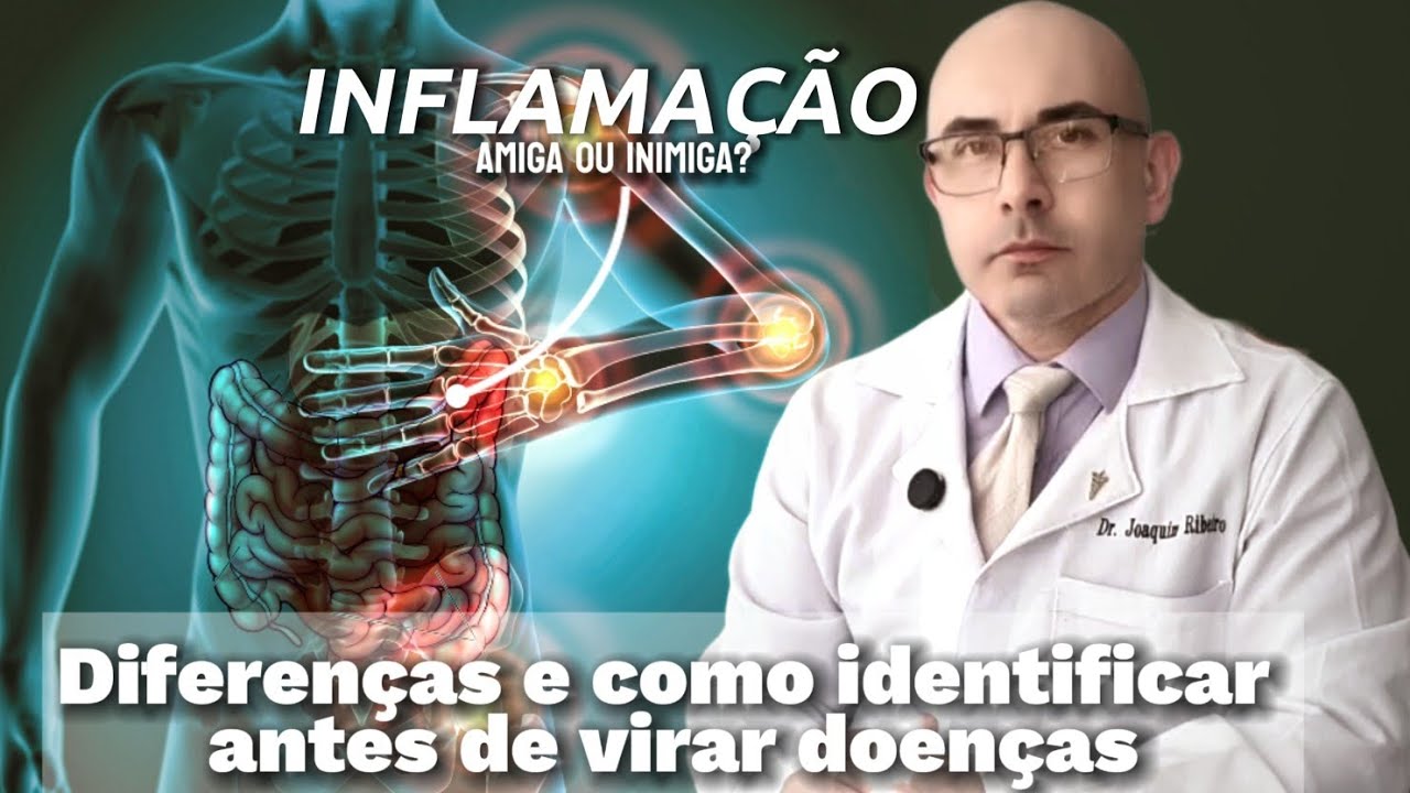 INFLAMAÇÃO: o Corpo Grita e Você Ignora – 5 DICAS e a última é mais IMPORTANTE você Precisa Saber