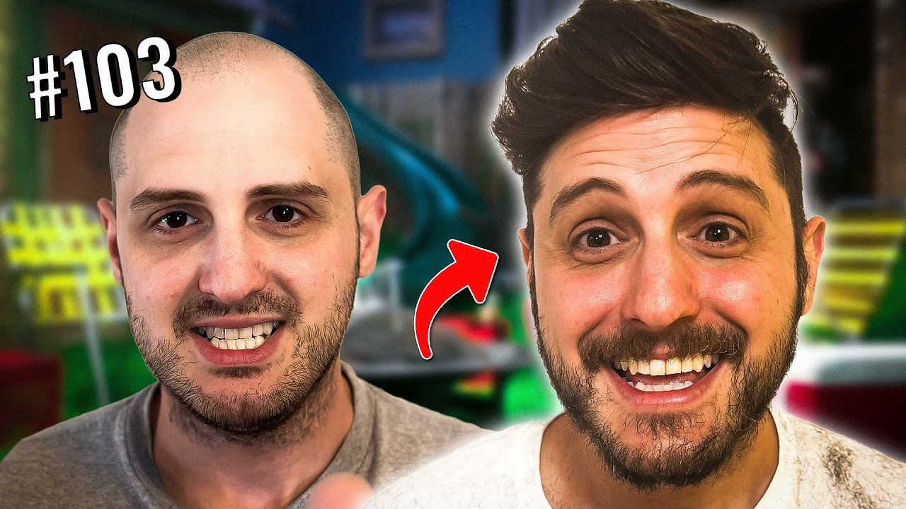 WE GAVE HIM HAIR! | The Yard