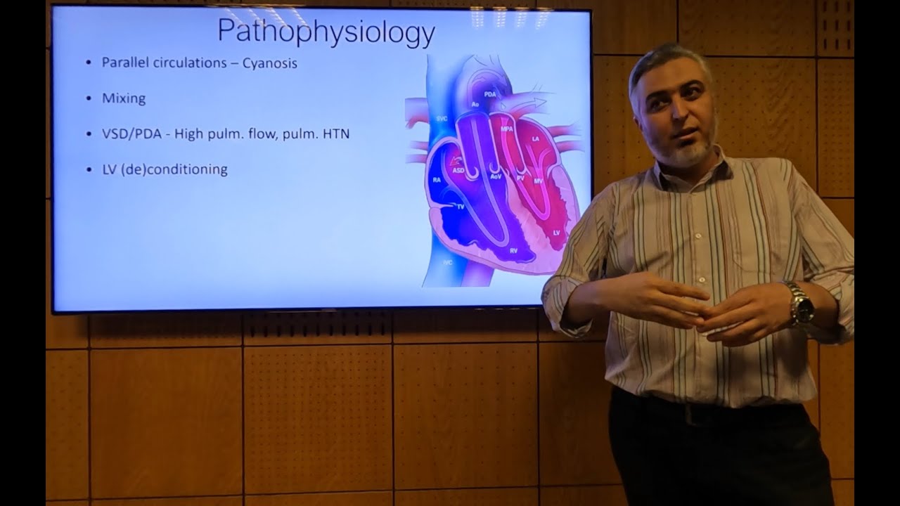 TGA: Anatomy and Pathophysiology - Hatem Hosny