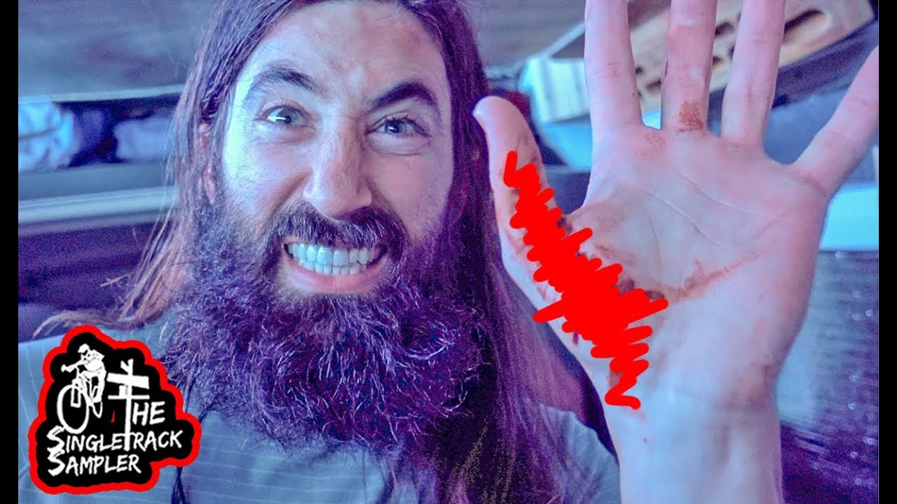 I THINK I'LL START WEARING GLOVES AGAIN... // The Singletrack Sampler