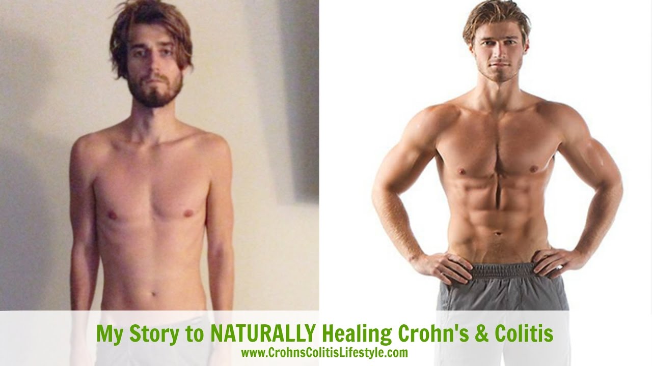 My Story of Healing Crohn's & Colitis Naturally