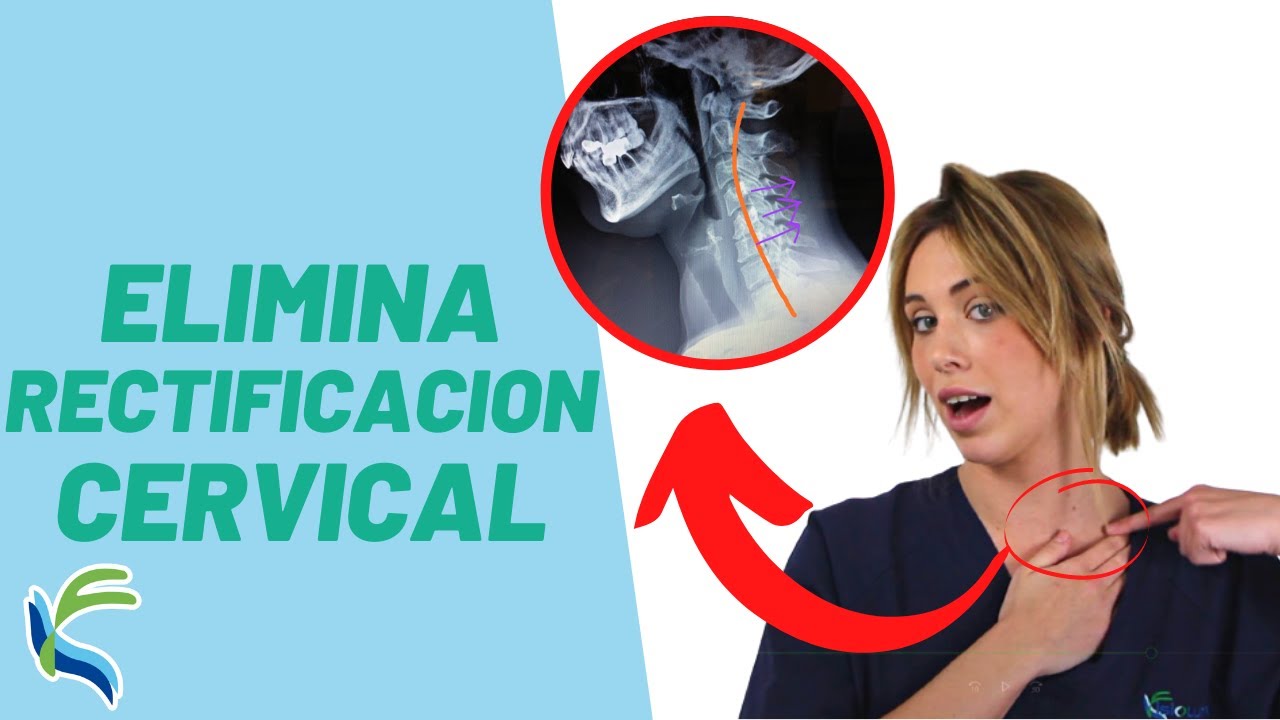 RECTIFICACIÓN CERVICAL cómo CURARLA en 5 EJERCICIOS | Fisiolution