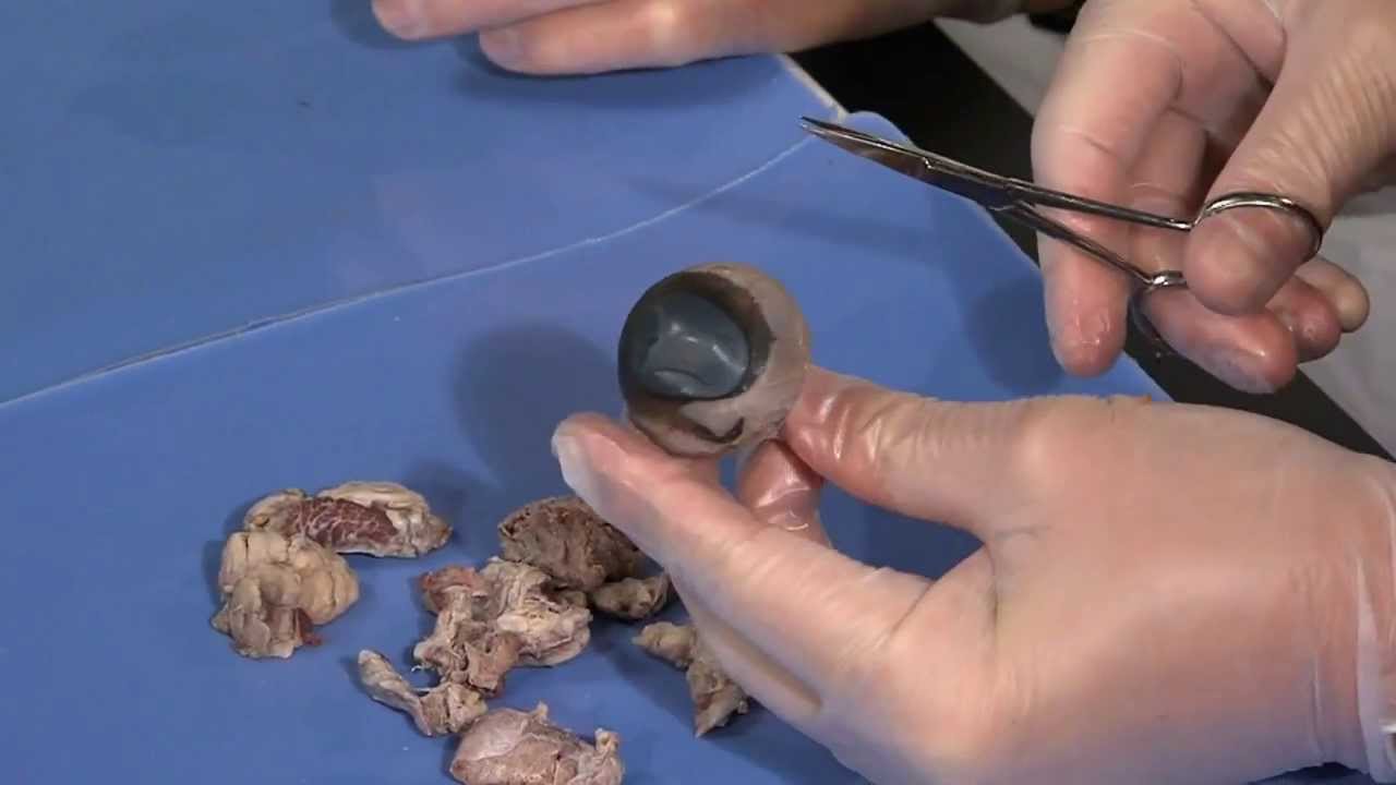 Detailed Cow Eye Dissection: Part I (Jr. High, High School and College Review)