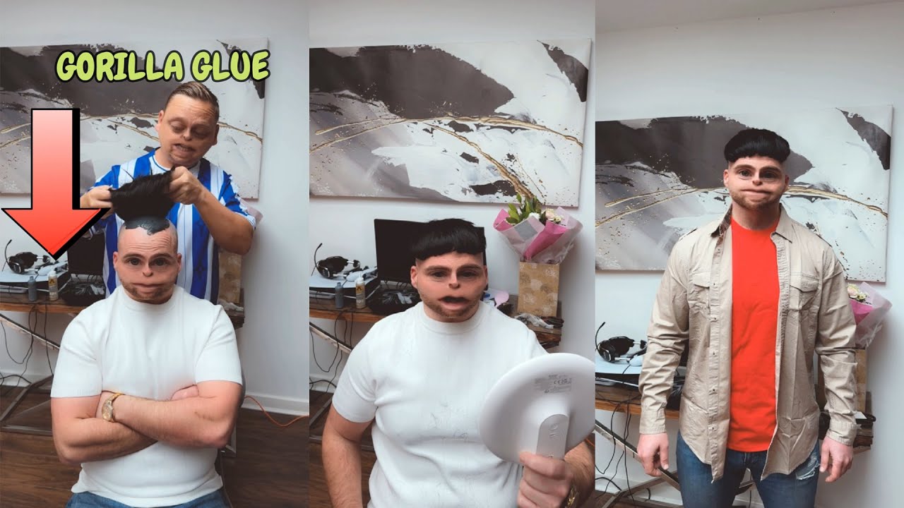 невероятные результаты пересадки волос
