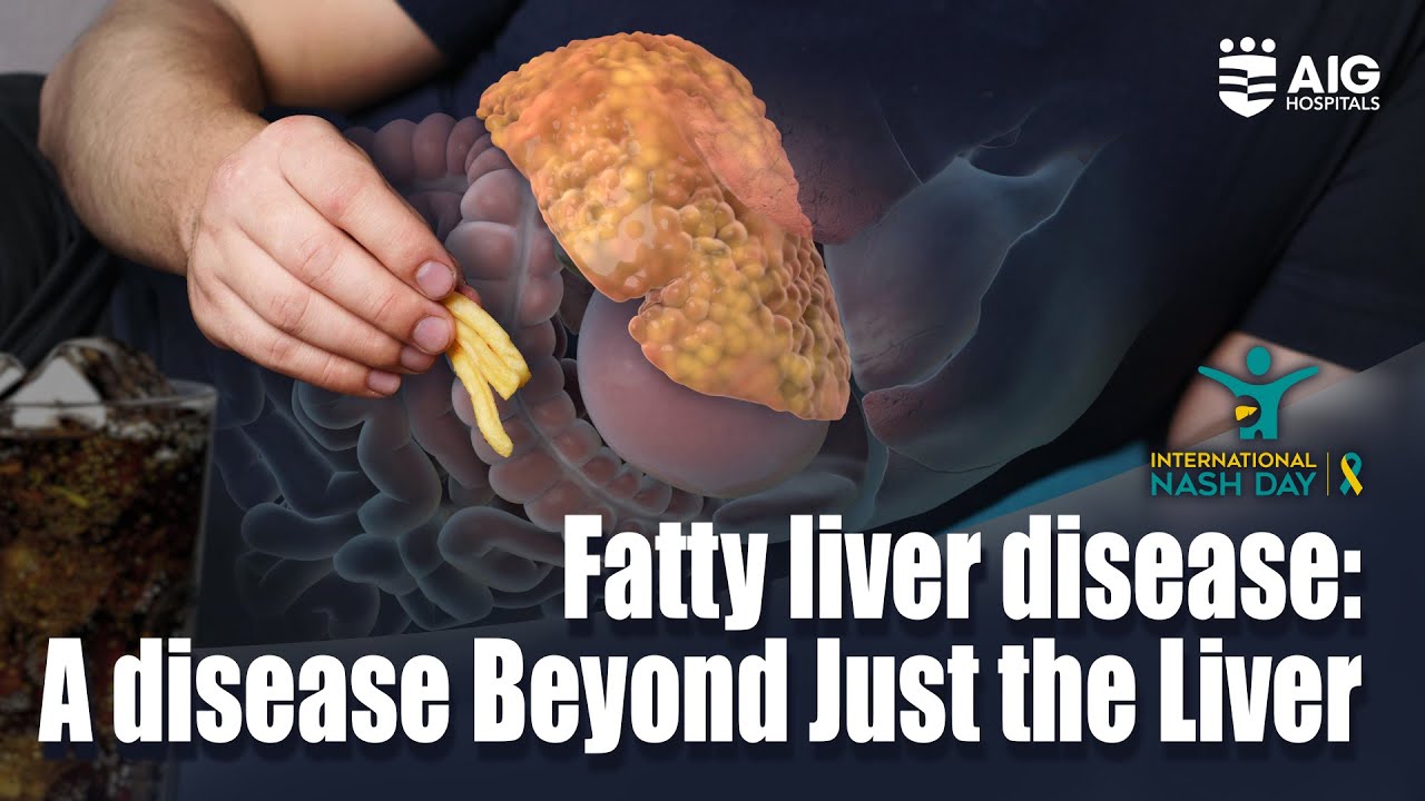 Fatty Liver Disease: A disease beyond just the liver | AIG Hospitals