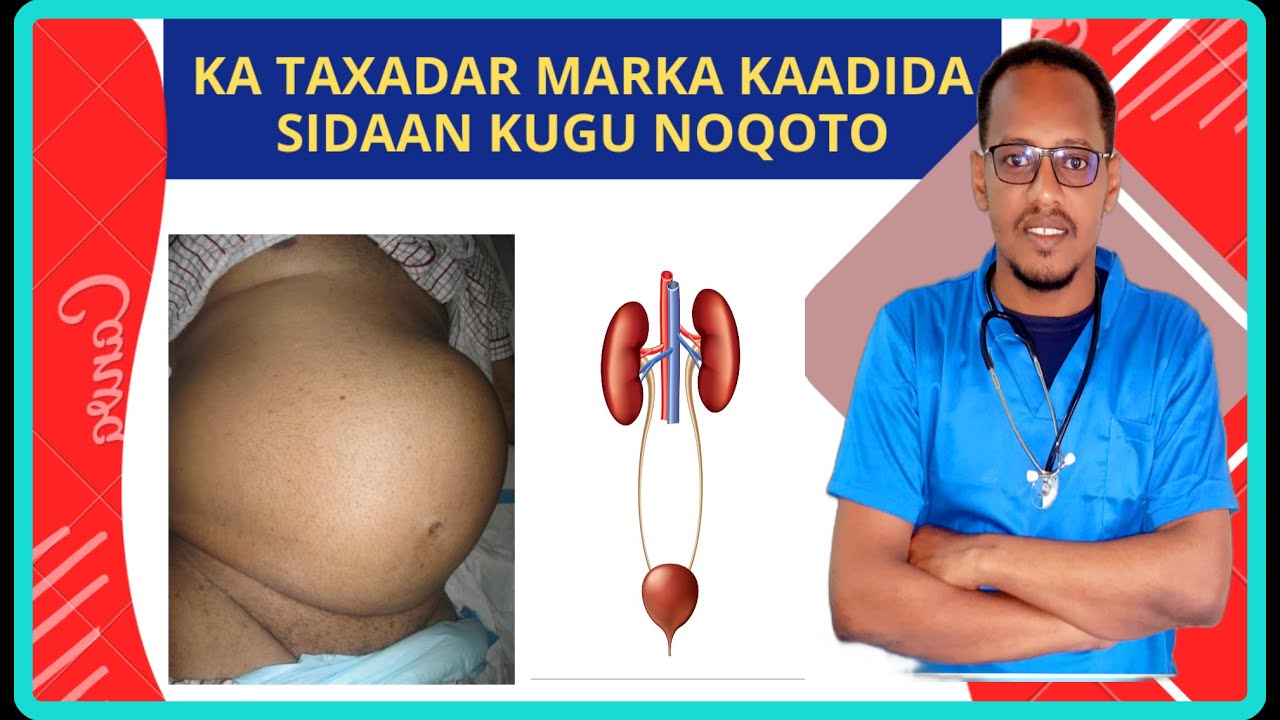 Marka kaadida kugu Istaagto Urine Retention Calamadaha Lagu Garto & sida fudud ad isaga Daweyn Karto