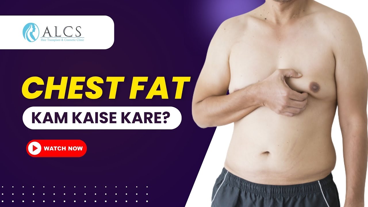 How to Reduce Chest Fat Naturally & When Surgery Is the Only Option | Dr. Sunil Arora