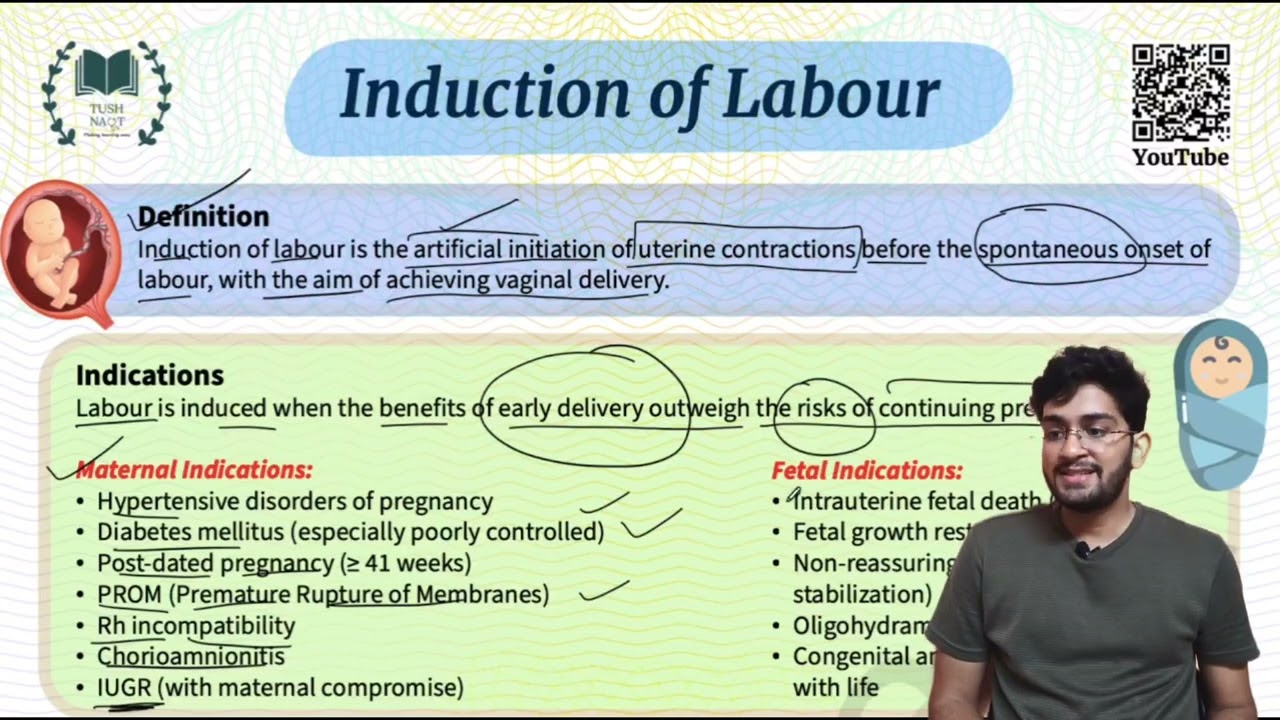 Induction of labour - Easy notes and explanation