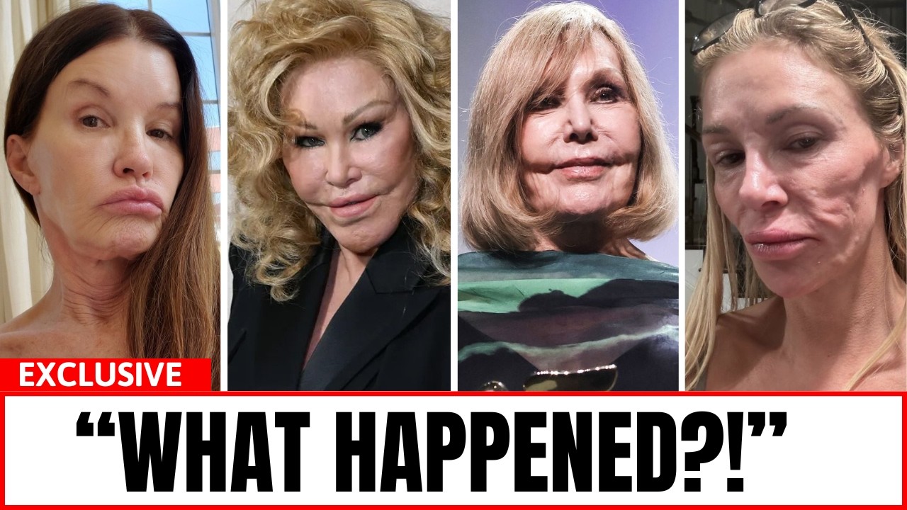 10 Celebrity Plastic Surgery Transformations That Shocked Fans - Then and Now 2026