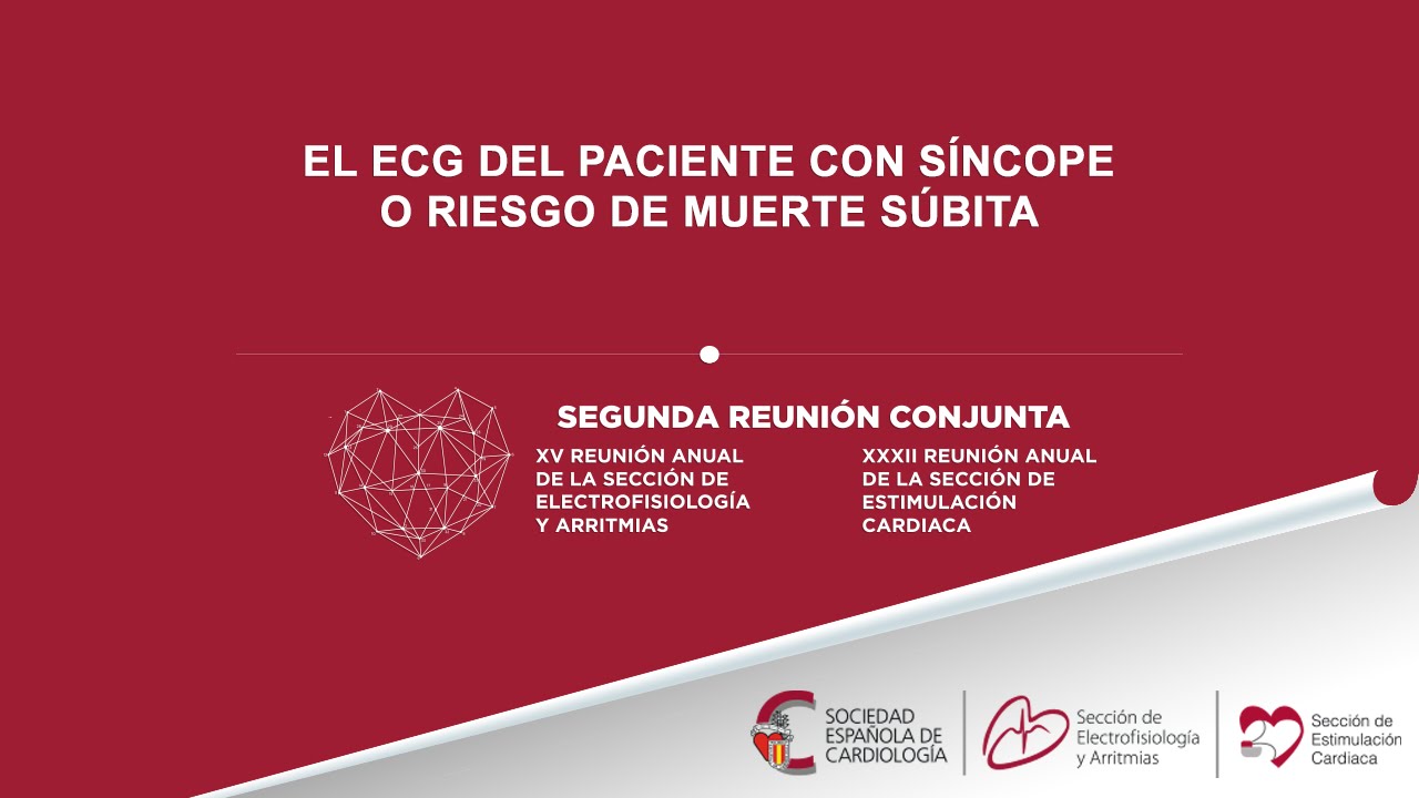 El ECG del paciente con síncope o riesgo de muerte súbita