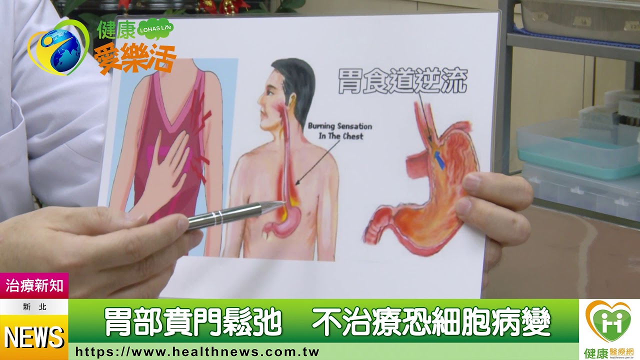 頭皮針+耳針　扎走胃食道逆流