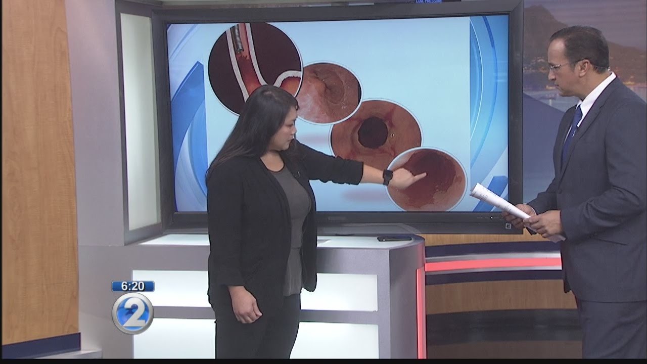 Ask a Specialist: Barrett&rsquo;s Esophagus