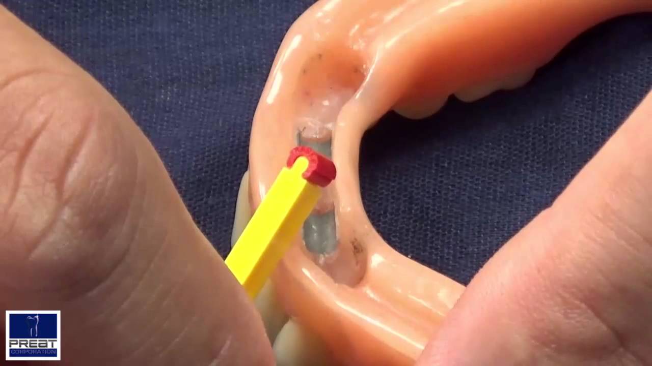 How to Change A Hader Clip