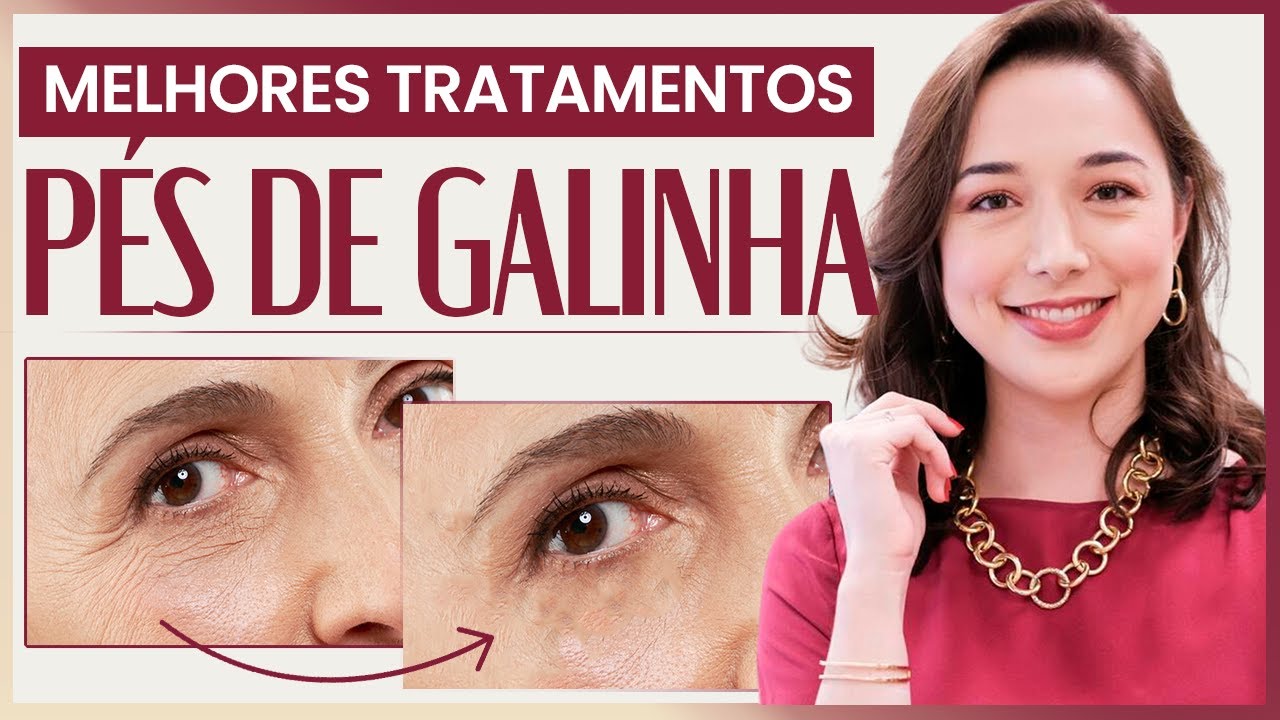 RUGAS PÉ DE GALINHA | Como amenizar essas linhas na ÁREA DOS OLHOS