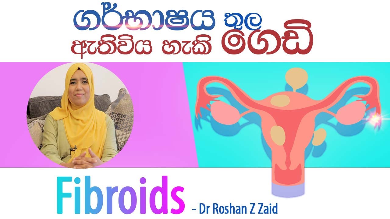 ගර්භාෂය තුල ඇතිවන ගෙඩි | Fibroids