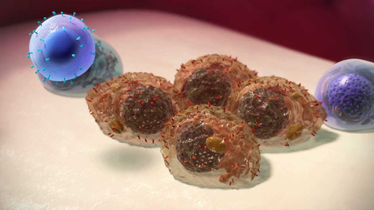 Myeloma UK CAR-T treatment in myeloma