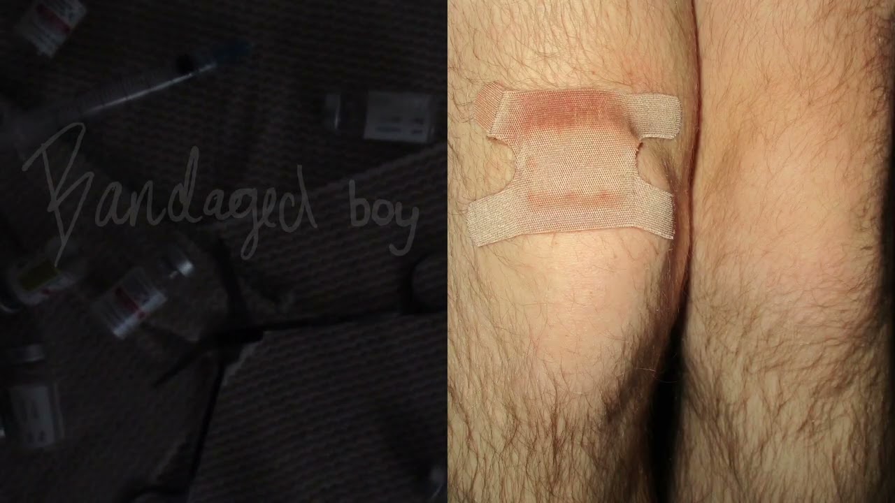 bandaged boy