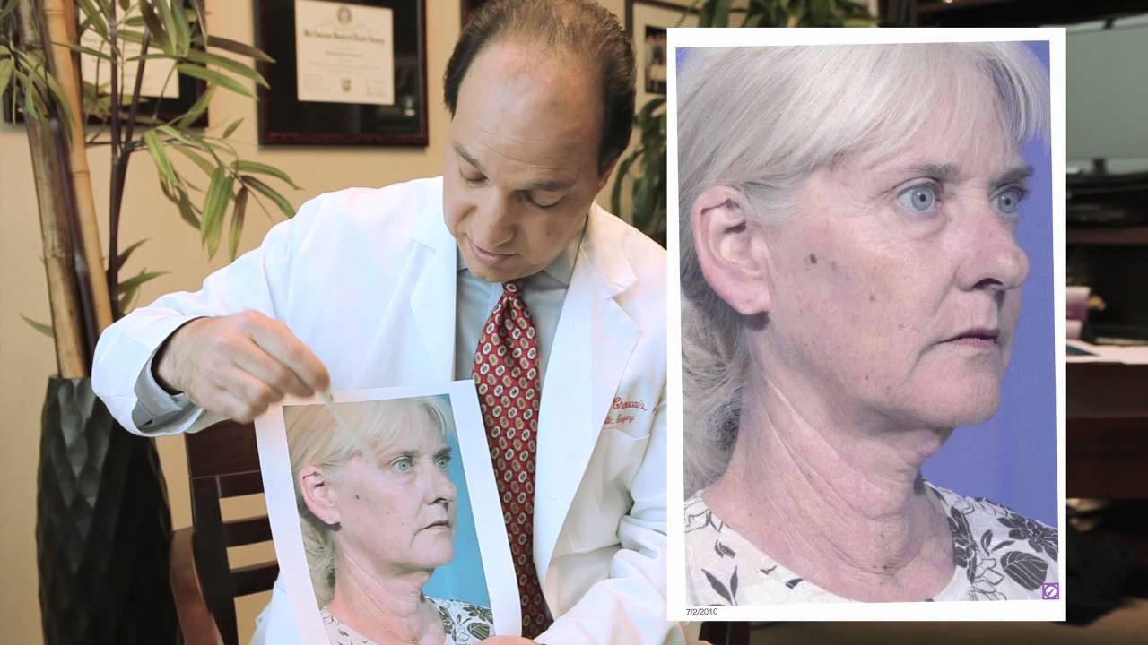 The FacePlan: FaceLift vs Fillers with Dr. Ramsey J.Choucair, M.D.