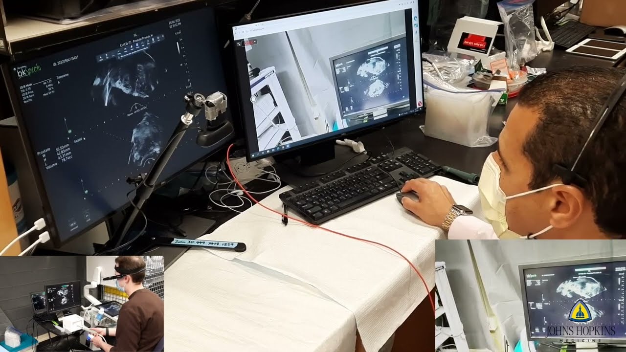 Ultrasound-Guided Prostate Biopsy Model | SLICE