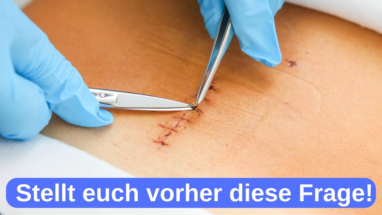 Bandscheibenoperation Lendenwirbelsäule (LWS) - Das sagen euch die wenigsten Ärzte!