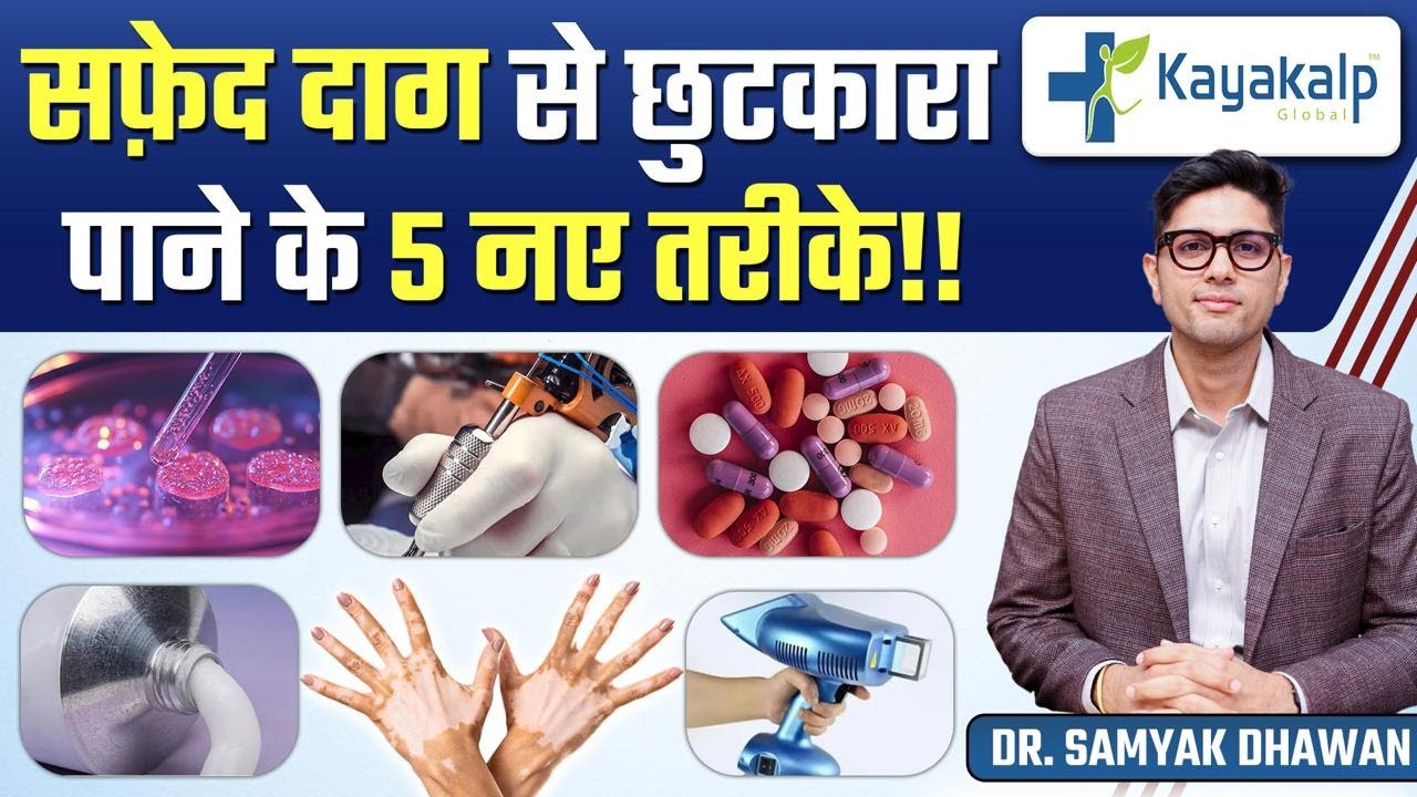 5 New Treatments of Vitiligo (Safed Daag) | Vitiligo Skin Disease Treatment | Kayakalp Global