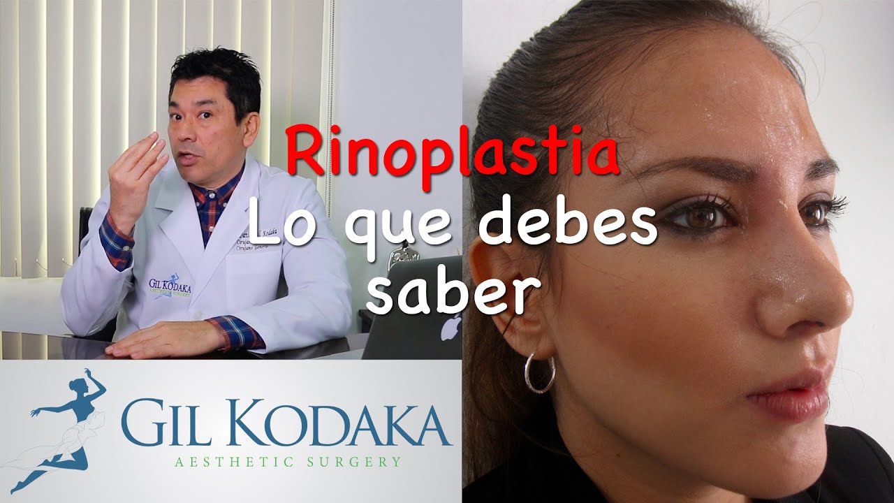 ¿Qué es la Rinoplastia? - La Cirugía de la Nariz