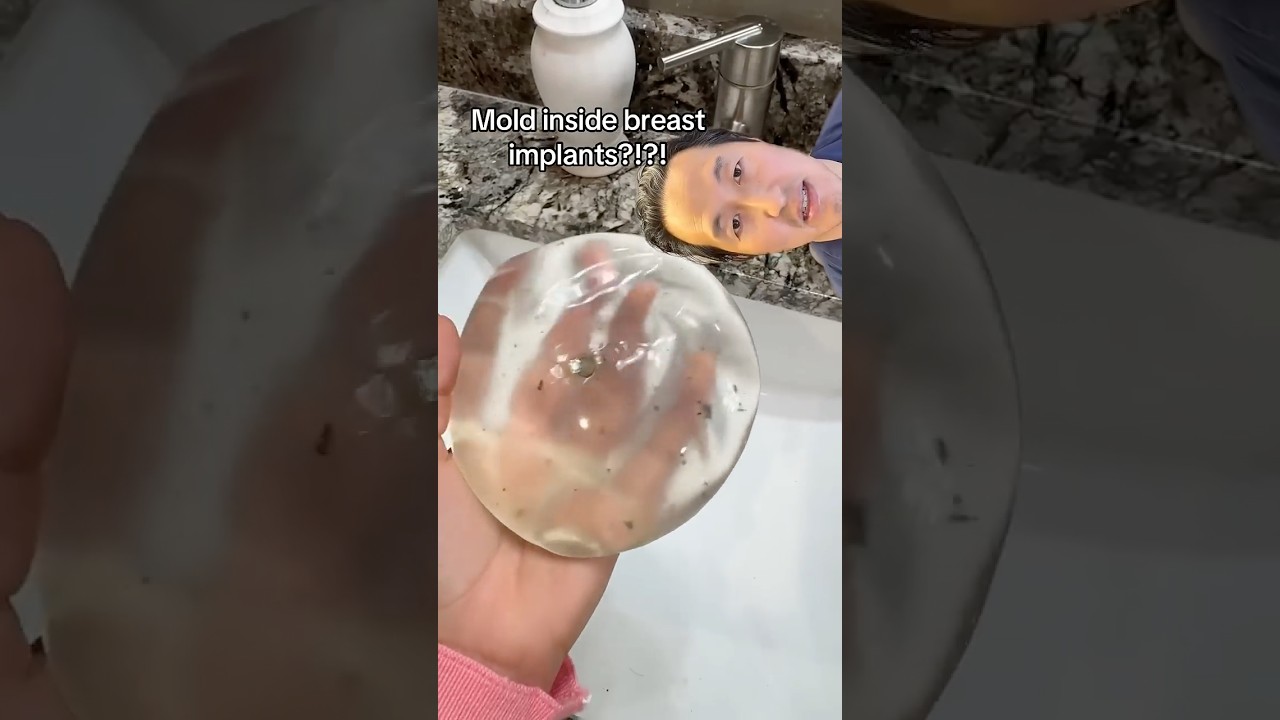 How Do You Get Mold Inside Breast Implants?