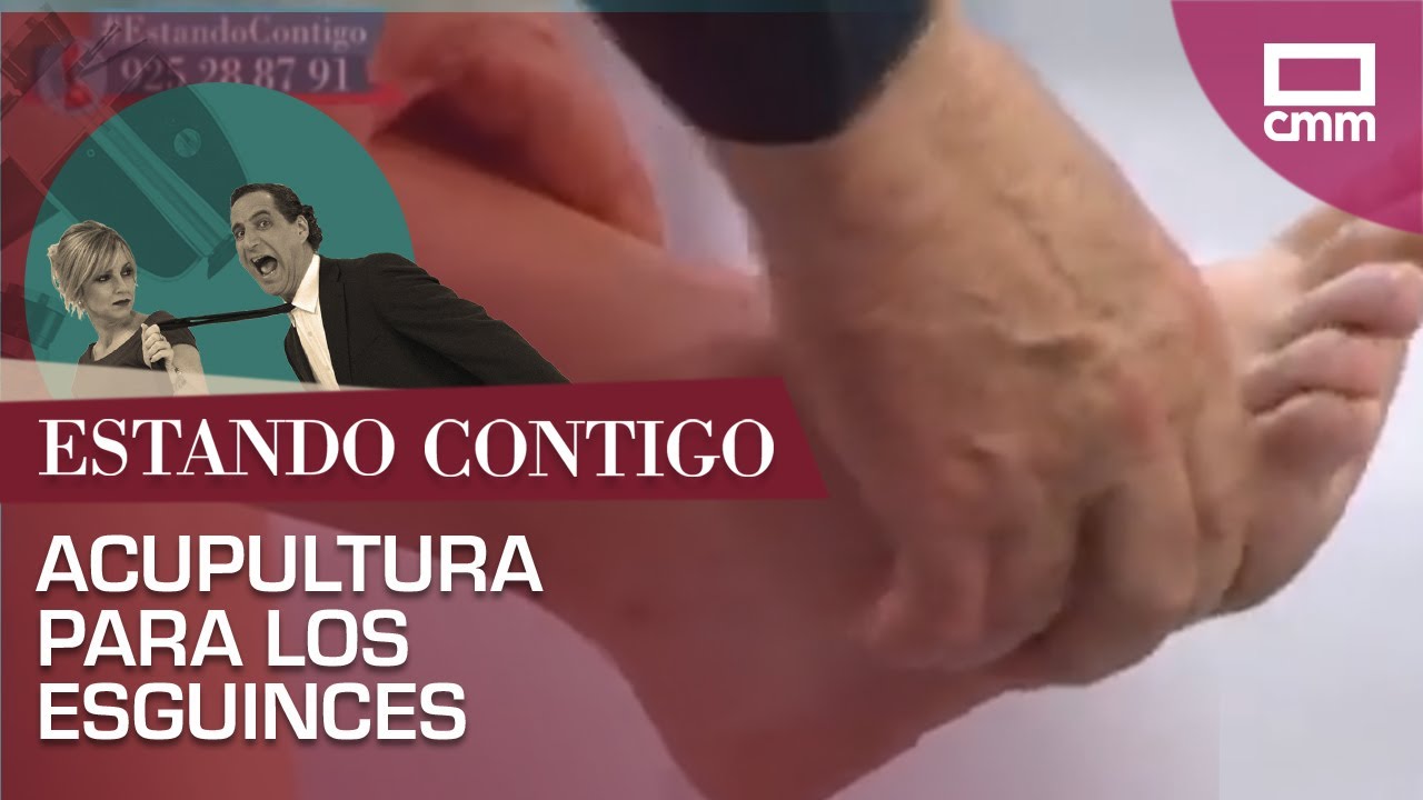 Acupuntura para los esguinces | Estando Contigo