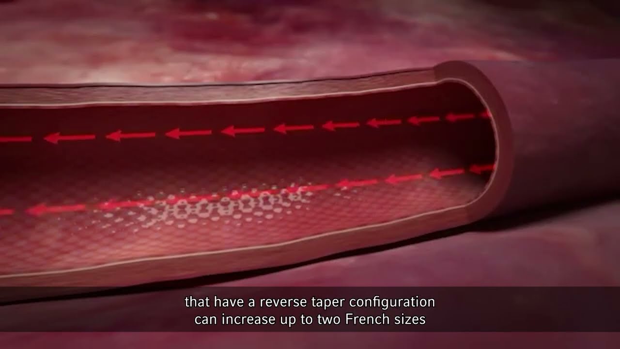 Arrow&reg; PICC Catheters &ndash; Tapered vs Non-Tapered Animated Video